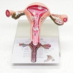 Uterus Ovary Model Body Anatomy Replica of Female Reproductive System Organ Anatomical Model with base showing the common Pathologies for Doctors Office Educational Tool